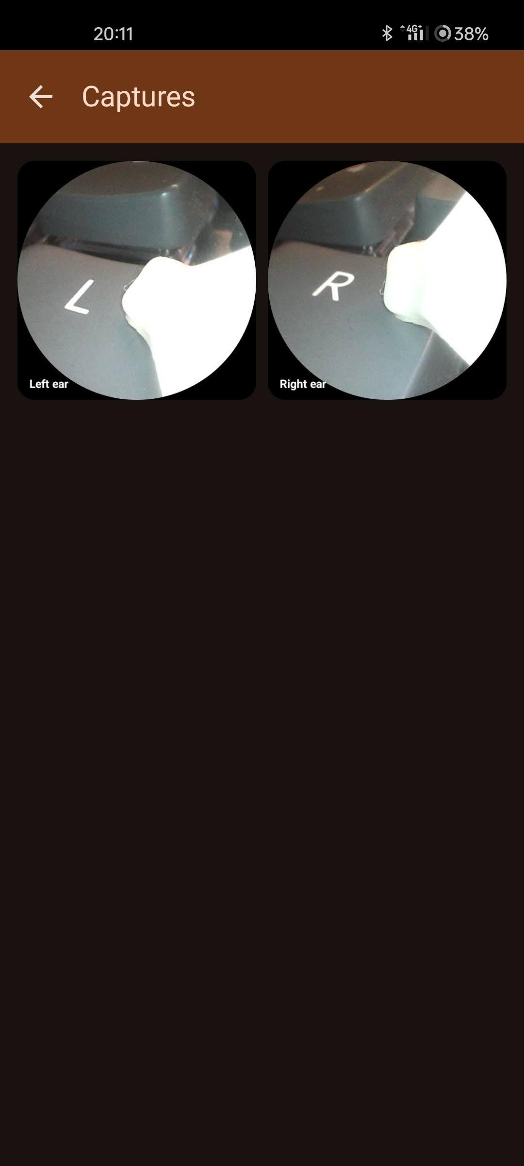 Otoscope screenshot 12