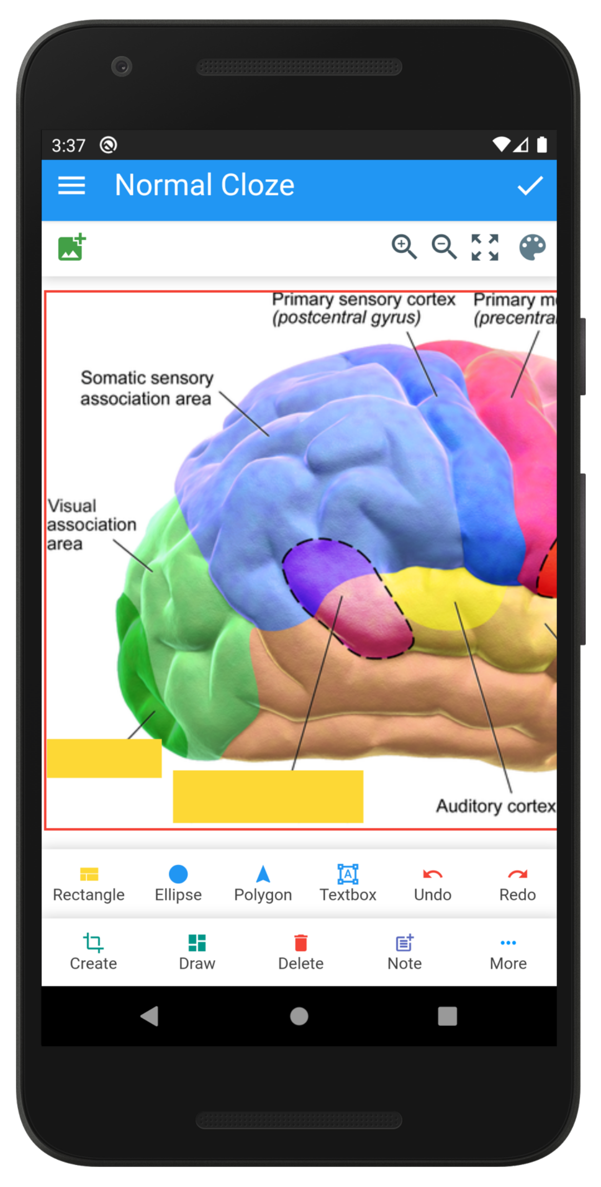 Anki Image Occlusion screenshot 1