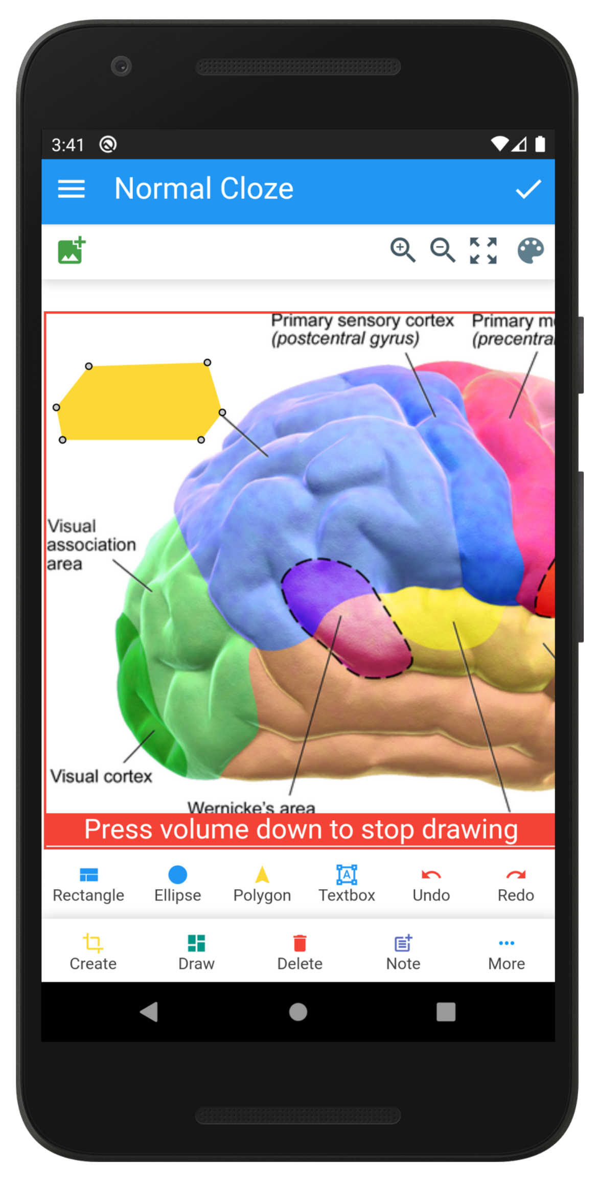 Anki Image Occlusion screenshot 3