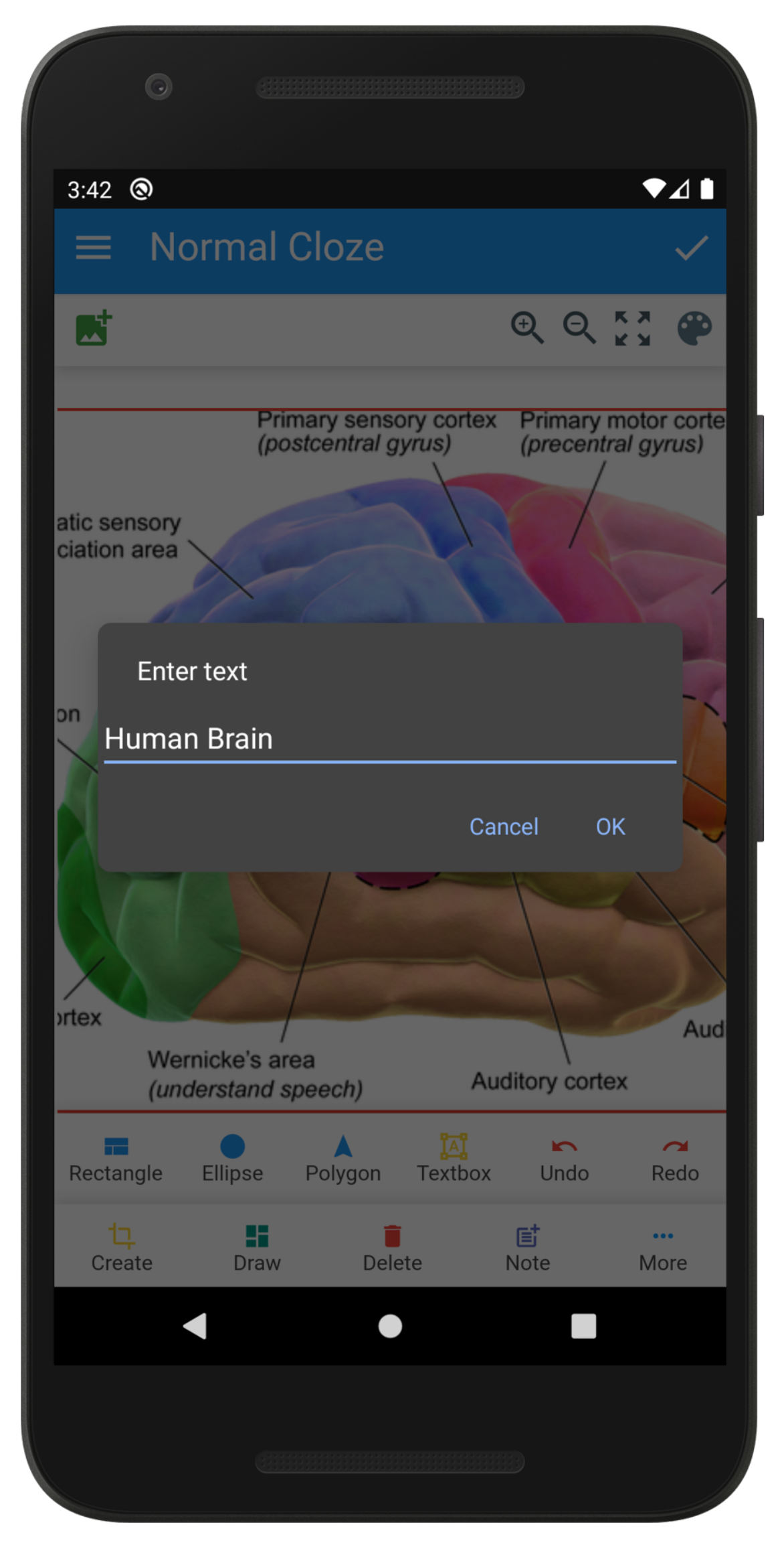 Anki Image Occlusion screenshot 4