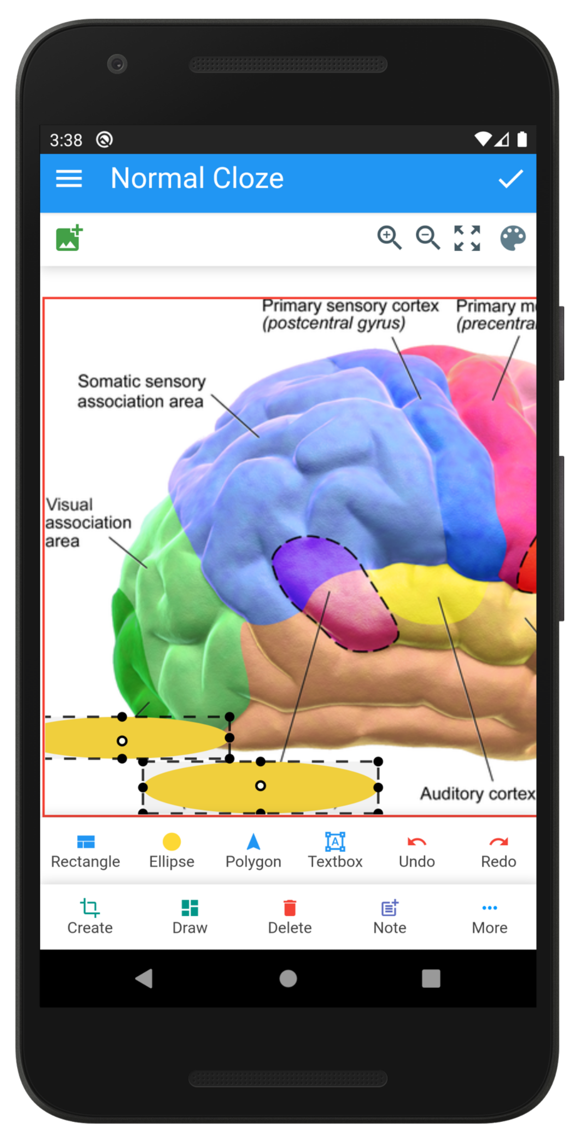 Anki Image Occlusion screenshot 2